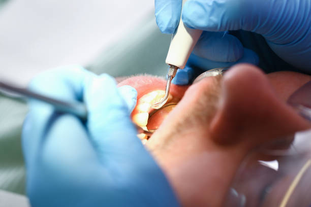 Best Emergency Denture Repair in Ladoga, IN